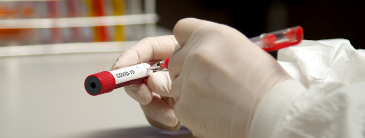 Close-up of a scientist marking COVID-19 test tube with pen